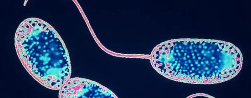 Czy można przesadzić z bakteriami w akwarium? Oto co warto wiedzieć